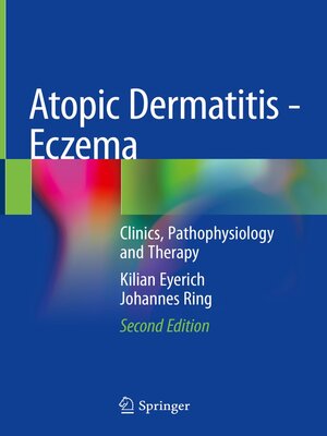 cover image of Atopic Dermatitis--Eczema
